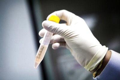 New test may improve diagnosis of pancreatic cancers