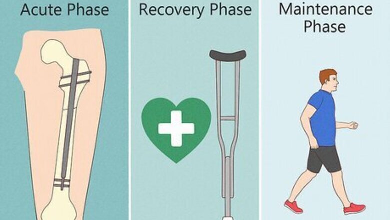 How to Treat a Broken Femur