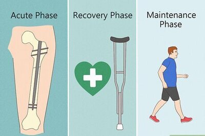 How to Treat a Broken Femur