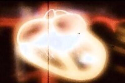 Reduction on LDL lessens heart disease risk