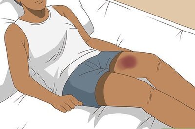 How to Treat a Bruised Thigh Muscle