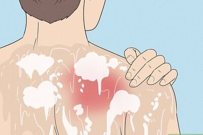 How to Wash Icy Hot off