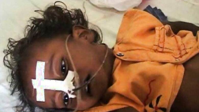 6 more children succumb to encephalitis; toll mounts to 590