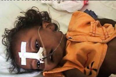 6 more children succumb to encephalitis; toll mounts to 590