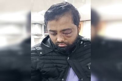 Delhi Waqf Board Gives Rs 5 Lakh, Job to Student who Lost Eye in Jamia Violence