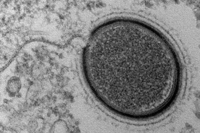 2 Deaths Due to 'Monkey Fever' Prompt Health Officials in K'taka to Review Precautionary Measures