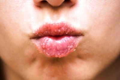 Get Plump and Pink Lips in Summer With These DIY Scrubs