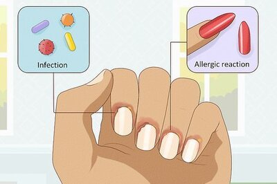 How to Stop Itchy Cuticles