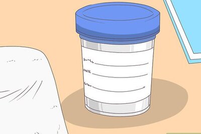How to Collect a Sterile Urine Sample
