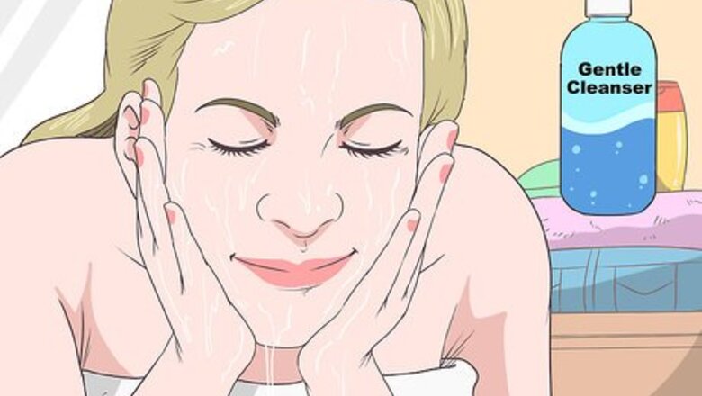 How to Stop Whiteheads