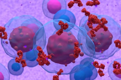 Multiple Myeloma: Causes, Symptoms, And Treatment