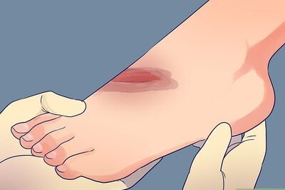 How to Treat Deep Cuts