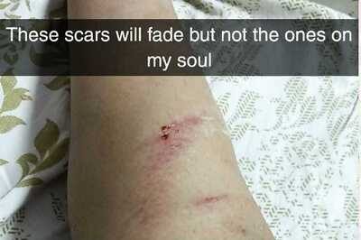 Indore Model's Skirt Pulled on Busy Road, Molesters Say 'Show What's Underneath'