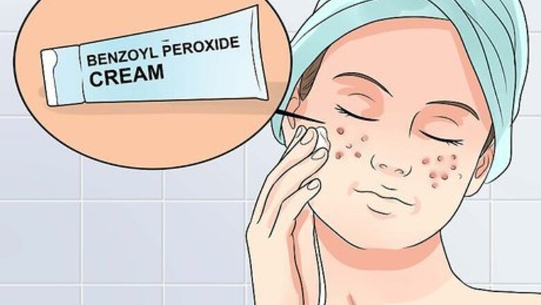 How to Clear Mild Acne Fast